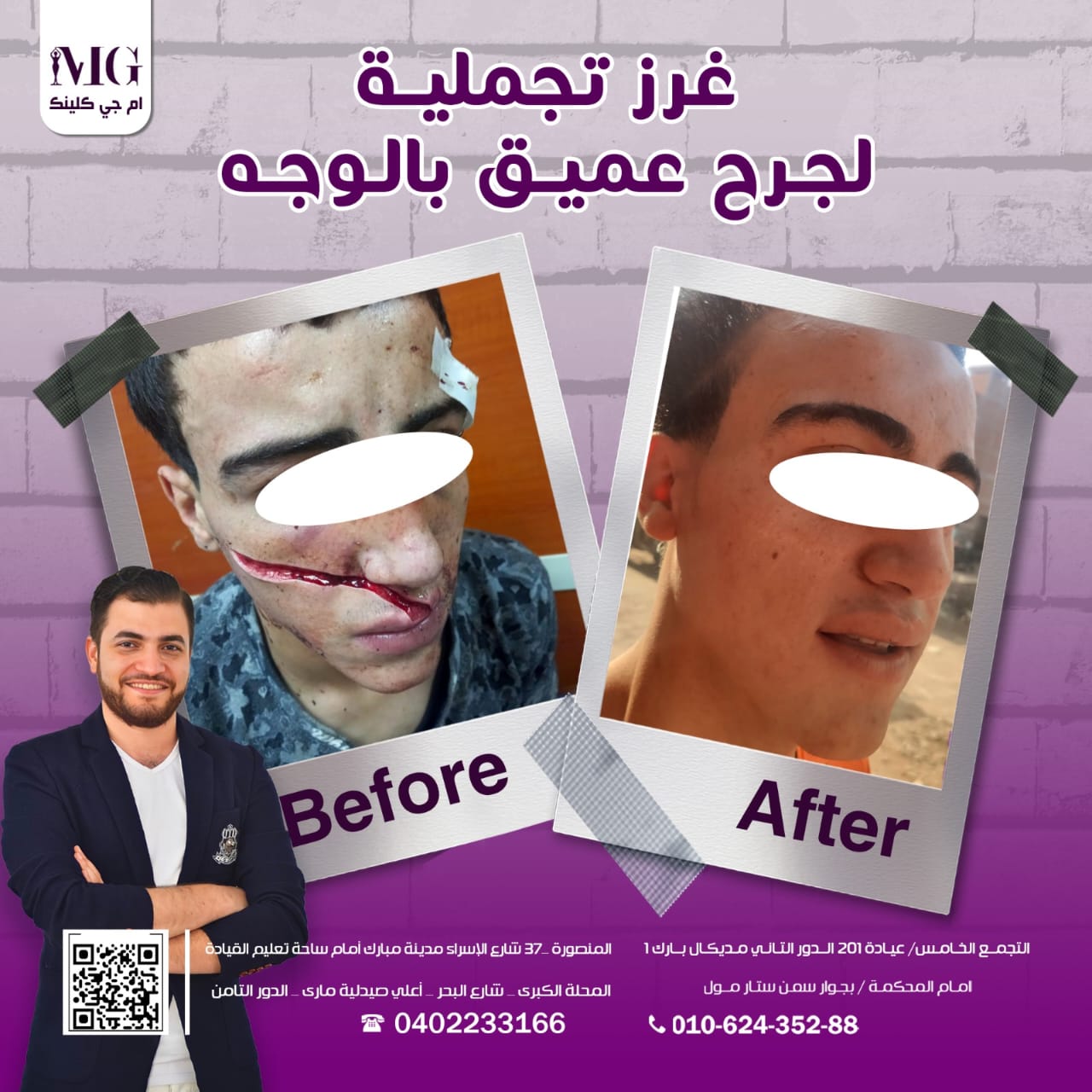 نتيجة تجميل شامل — قبل وبعد